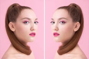 rhinoplasty before and after