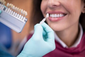 Teeth Whitening in Riyadh