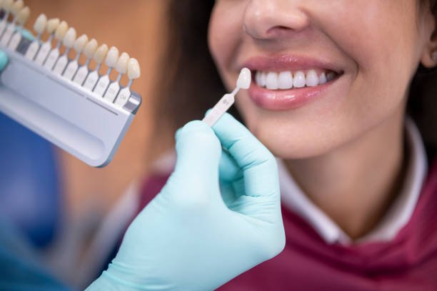 Teeth Whitening in Riyadh