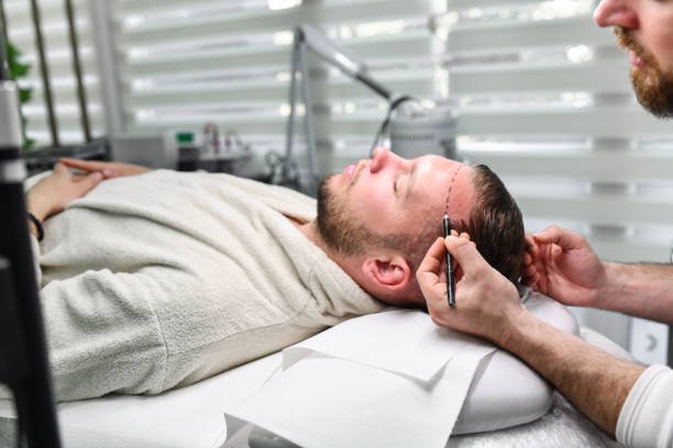How Hair Transplant Improves Confidence Fast