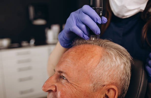 Hair transplant in Dubai